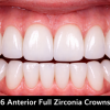 Edentalab - Product - Zirconia
